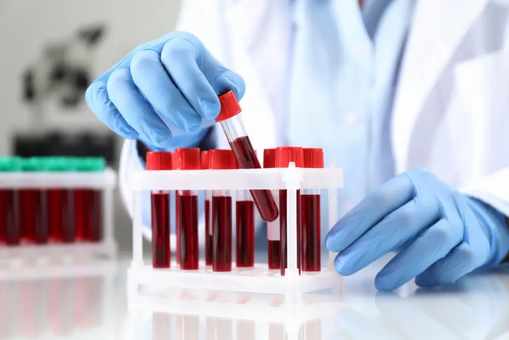 Técnico de laboratorio clínico manipulando tubos con muestras de sangre para un análisis de parámetros biológicos.